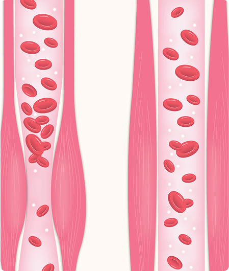 Period-Cramps.png